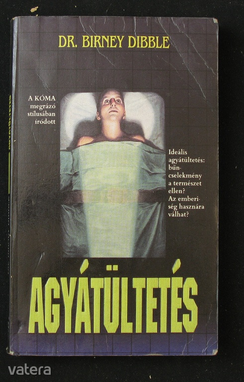 Dibble: Agyátültetés