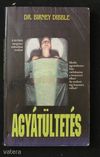 Dibble: Agyátültetés